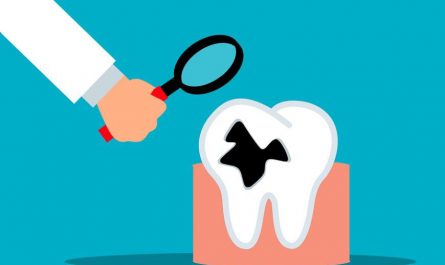 Soñar con dientes podridos : 11 escenarios y significados