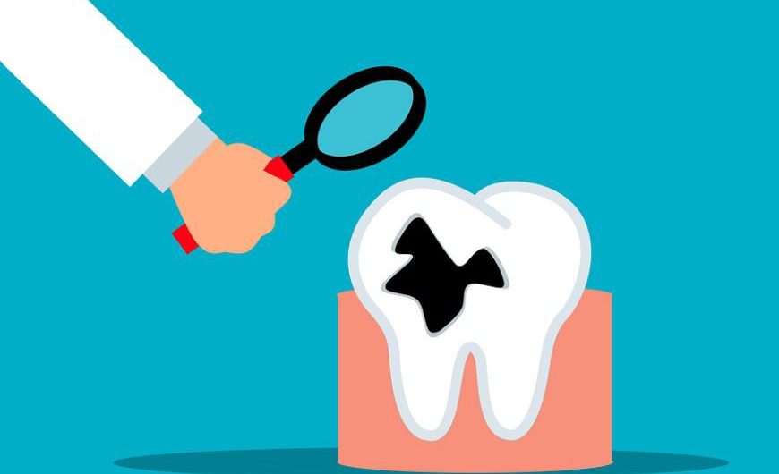 Soñar con dientes podridos  : 11 escenarios y significados