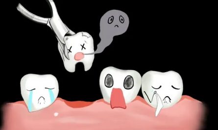 Soñar con que te extraen un diente en el dentista : 16 significado y simbolismo