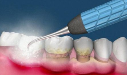 Soñar con la limpieza dental : 12 significado y simbolismo