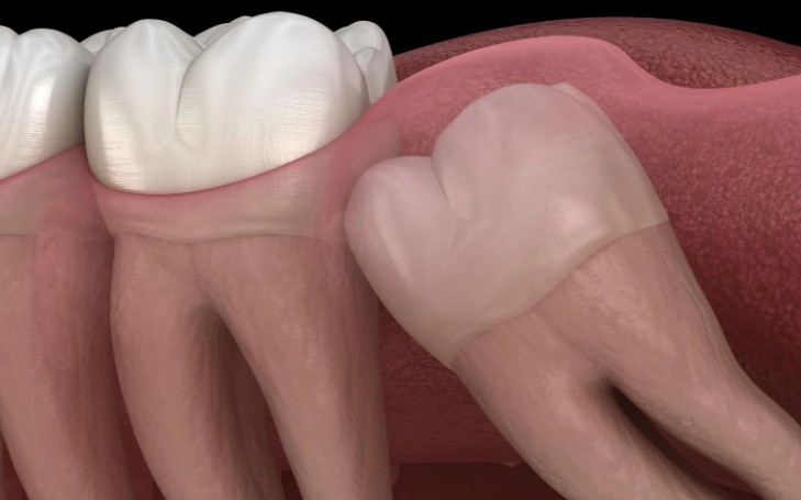Soñar con muelas del juicio : 16 significado y simbolismo