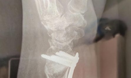 Soñar con una muñeca rota : 16 significado y simbolismo