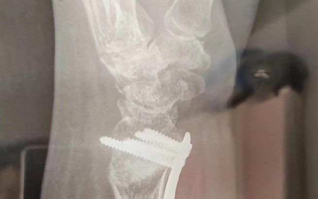 Soñar con una muñeca rota : 16 significado y simbolismo