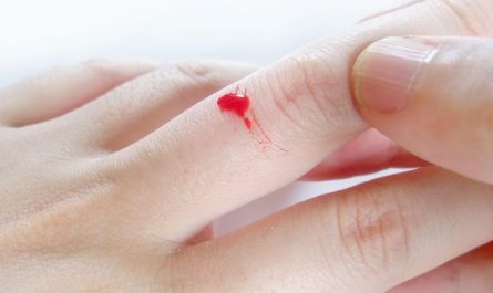 Soñar con dedos sangrantes : 18 significado y simbolismo