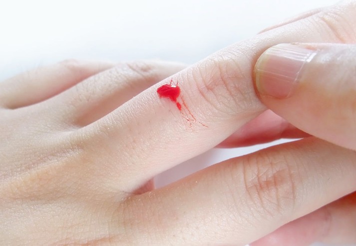 Soñar con dedos sangrantes : 18 significado y simbolismo