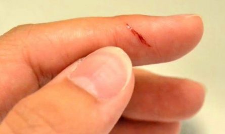 Soñar con cortarse un dedo : 14 significado y simbolismo