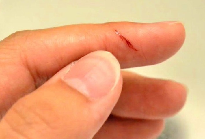 Soñar con cortarse un dedo : 14 significado y simbolismo