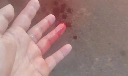 Soñar con que te cortan un dedo : 30 significado y simbolismo