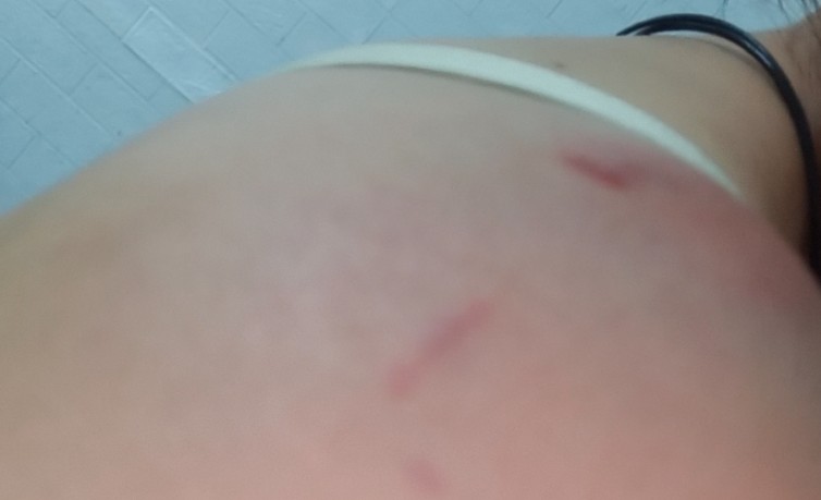 Soñar que tu esposo te golpea: 11 significados y simbolismos