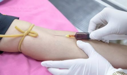 24 Significados de Soñar con Donar Sangre