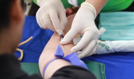20 Significados de Soñar con Extraer Sangre